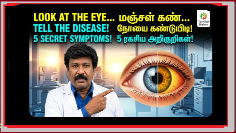 உடல் உறுப்புகள் பேசும் மொழி! - உங்கள் கண்கள் சொல்லும் ரகசிய நோய்கள் எவை? விழிப்புணர்வு கட்டுரை! 👀🔍🩺